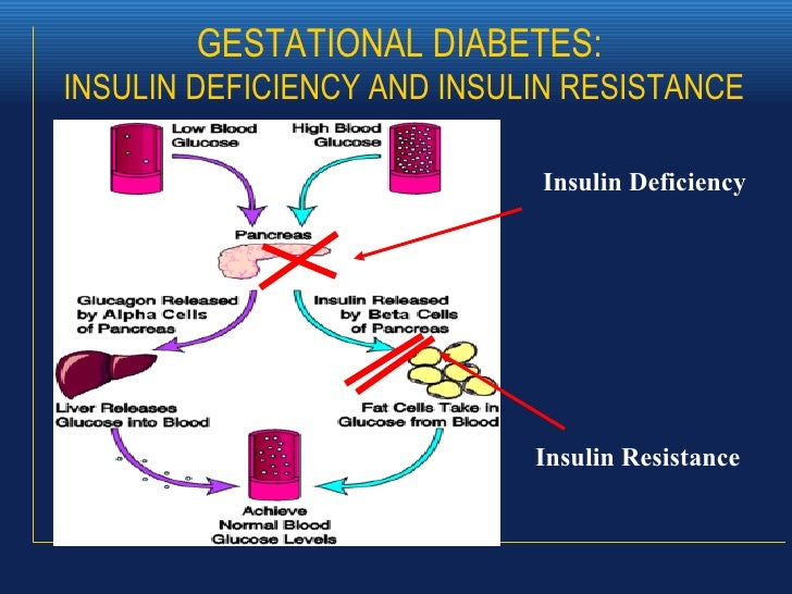 Gestational Diabetes