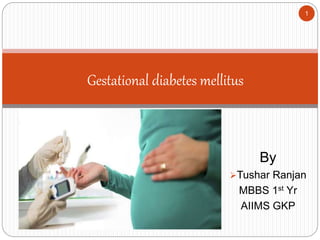 By
Tushar Ranjan
MBBS 1st Yr
AIIMS GKP
Gestational diabetes mellitus
1
 