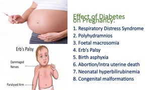 Effect of Diabetes
on Pregnancy:
1. Respiratory Distress Syndrome
2. Polyhydramnios
3. Foetal macrosomia
4. Erb’s Palsy
5. Birth asphyxia
6. Abortion/Intra uterine death
7. Neonatal hyperbilirubinemia
8. Congenital malformations
 