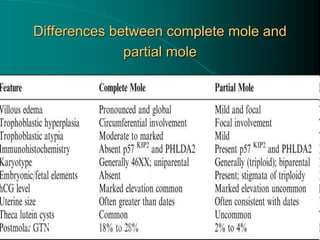 Differences between complete mole and
partial mole
11/26/2019 Reproductive Health Module AL2013
 