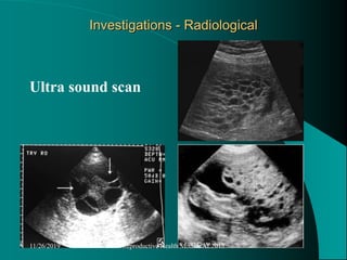 Investigations - Radiological
Ultra sound scan
11/26/2019 Reproductive Health Module AL2013
 