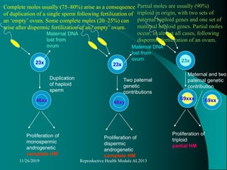 46xx
23x
Proliferation of
monospermic
androgenetic
complete HM
Duplication
of haploid
sperm
Maternal DNA
lost from
ovum
46xy
23x
Proliferation of
dispermic
androgenetic
complete HM
Two paternal
genetic
contributions
Maternal DNA
lost from
ovum
69xxx
23x
Proliferation of
triploid
partial HM
Maternal and two
paternal genetic
contribution
69xxy
11/26/2019 Reproductive Health Module AL2013
Complete moles usually (75–80%) arise as a consequence
of duplication of a single sperm following fertilization of
an ‘empty’ ovum. Some complete moles (20–25%) can
arise after dispermic fertilization of an ‘empty’ ovum.
Partial moles are usually (90%)
triploid in origin, with two sets of
paternal haploid genes and one set of
maternal haploid genes. Partial moles
occur, in almost all cases, following
dispermic fertilization of an ovum.
 