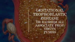 GESTATIONAL
TROPHOBLASTIC
DISEASE
DR RAISHEM ALI
ASSOCIATE PROF:
OBGYN
PUMHS
 