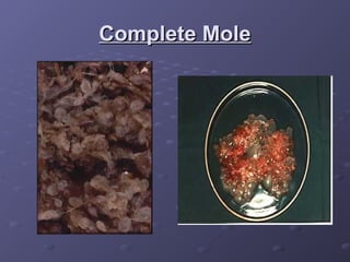Complete Mole
Complete Mole
 