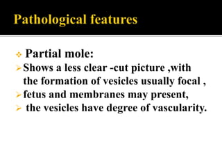   Partial mole:
 Shows  a less clear -cut picture ,with
  the formation of vesicles usually focal ,
 fetus and membranes may present,
 the vesicles have degree of vascularity.
 
