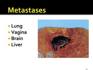  Lung
 Vagina
 Brain
 Liver




           •68
 