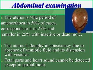 Abdominal examinationAbdominal examination
1.1. The uterus is >the period ofThe uterus is >the period of
amenorrhoea in 50...