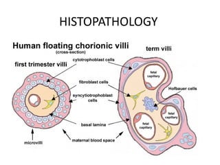 HISTOPATHOLOGY
 