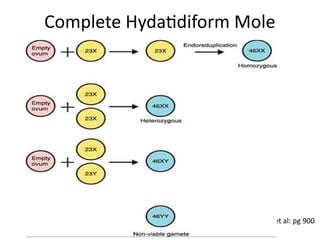 Source: Williams GYNECOLOGY, 2nd EDITION, by Barbara L. Hoffman, MD, et al: pg 900
Complete Hydatidiform Mole
 
