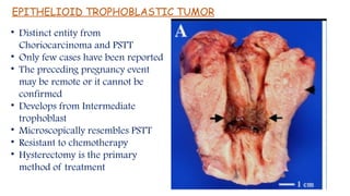 Pstt gestational trophoblastic neoplasia seminar.pptx