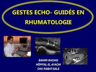 GESTES ECHO- GUIDÉS EN 
RHUMATOLOGIE 
BAHIRI RACHID 
HÔPITAL EL AYACHI 
CHU RABAT-SALE 
 