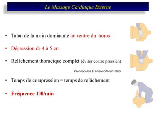 Talon de la main dominante  au centre du thorax Dépression de 4 à 5 cm Relâchement thoracique complet  (éviter contre pression) Temps de compression = temps de relâchement Fréquence 100/min Yannopoulos D Resuscitation 2005 Le Massage Cardiaque Externe 