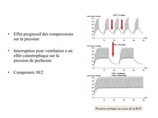 Effet progressif des compressions sur la pression Interruption pour ventilation a un effet catastrophique sur la pression de perfusion Compromis 30/2 Pression aortique au cours de la RCP 