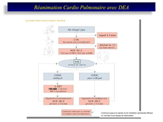 Continuer jusqu’à la reprise d’une ventilation spontanée efficace  ou l’arrivée d’une équipe de réanimation   DAE 150-200 Réanimation Cardio Pulmonaire avec DEA 