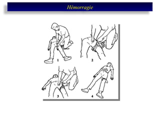 Hémorragie 