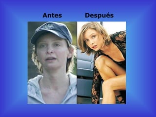 Antes   Después
 