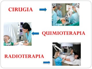 CIRUGIA
QUIMIOTERAPIA
RADIOTERAPIA
 