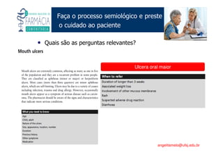 Existe um caminho que vai dos olhos ao coração sem passar pelo intelecto. (Gilbert Keith Chesterton)
Angelita C. Melo
angelitamelo@ufsj.edu.br
Faça o processo semiológico e preste
o cuidado ao paciente
• Quais são as perguntas relevantes?
Ulcera oral maior
 