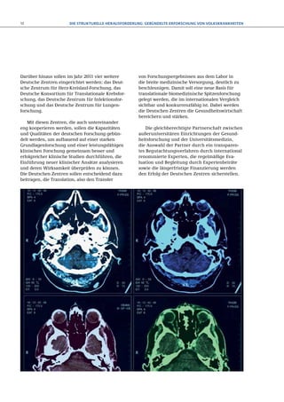 12                    Die strukturelle Herausforderung: Gebündelte Erforschung von Volkskrankheiten




Darüber hinaus sollen im Jahr 2011 vier weitere     von Forschungsergebnissen aus dem Labor in
Deutsche Zentren eingerichtet werden: das Deut-     die breite medizinische Versorgung, deutlich zu
sche Zentrum für Herz-Kreislauf-Forschung, das      beschleunigen. Damit soll eine neue Basis für
Deutsche Konsortium für Translationale Krebsfor-    translationale biomedizinische Spitzenforschung
schung, das Deutsche Zentrum für Infektionsfor-     gelegt werden, die im internationalen Vergleich
schung und das Deutsche Zentrum für Lungen-         sichtbar und konkurrenzfähig ist. Dabei werden
forschung.                                          die Deutschen Zentren die Gesundheitswirtschaft
                                                    bereichern und stärken.
   Mit diesen Zentren, die auch untereinander
eng kooperieren werden, sollen die Kapazitäten          Die gleichberechtigte Partnerschaft zwischen
und Qualitäten der deutschen Forschung gebün-       außeruniversitären Einrichtungen der Gesund-
delt werden, um aufbauend auf einer starken         heitsforschung und der Universitätsmedizin,
Grundlagenforschung und einer leistungsfähigen      die Auswahl der Partner durch ein transparen­  -
klinischen Forschung gemeinsam besser und           tes Begutachtungsverfahren durch international
erfolgreicher klinische Studien durchführen, die    renommierte Experten, die regelmäßige Eva-
Einführung neuer klinischer Ansätze analysieren     luation und Begleitung durch Expertenbeiräte
und deren Wirksamkeit überprüfen zu können.         sowie die längerfristige Finanzierung werden
Die Deutschen Zentren sollen entscheidend dazu      den Erfolg der Deutschen Zentren sicher­ tellen.
                                                                                             s
beitragen, die Translation, also den Transfer
 