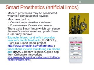 23

Smart Prosthetics (artificial limbs)
• Modern prosthetics may be considered

wearable computational devices
• May have built in:
• Onboard microcontrollers + software
• Force/movement/acceleration sensors

• There exist Smart limbs which can sense

the user‟s environment and predict how
a user may behave
• Example: bionic hand which provides
user with tactile feedback (PHOTO Top
Right EU „Smart Hand‟ project
http://www.elmat.lth.se/~smarthand/ )
• Innovations include monitoring via mobile
app (IMAGE bottom Right is Galileo app
from Orthocare Innovations
http://www.orthocareinnovations.com/orthoca
re.micro/index.html )

 
