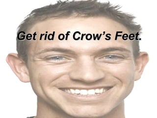 Get rid of Crow’s Feet.   
