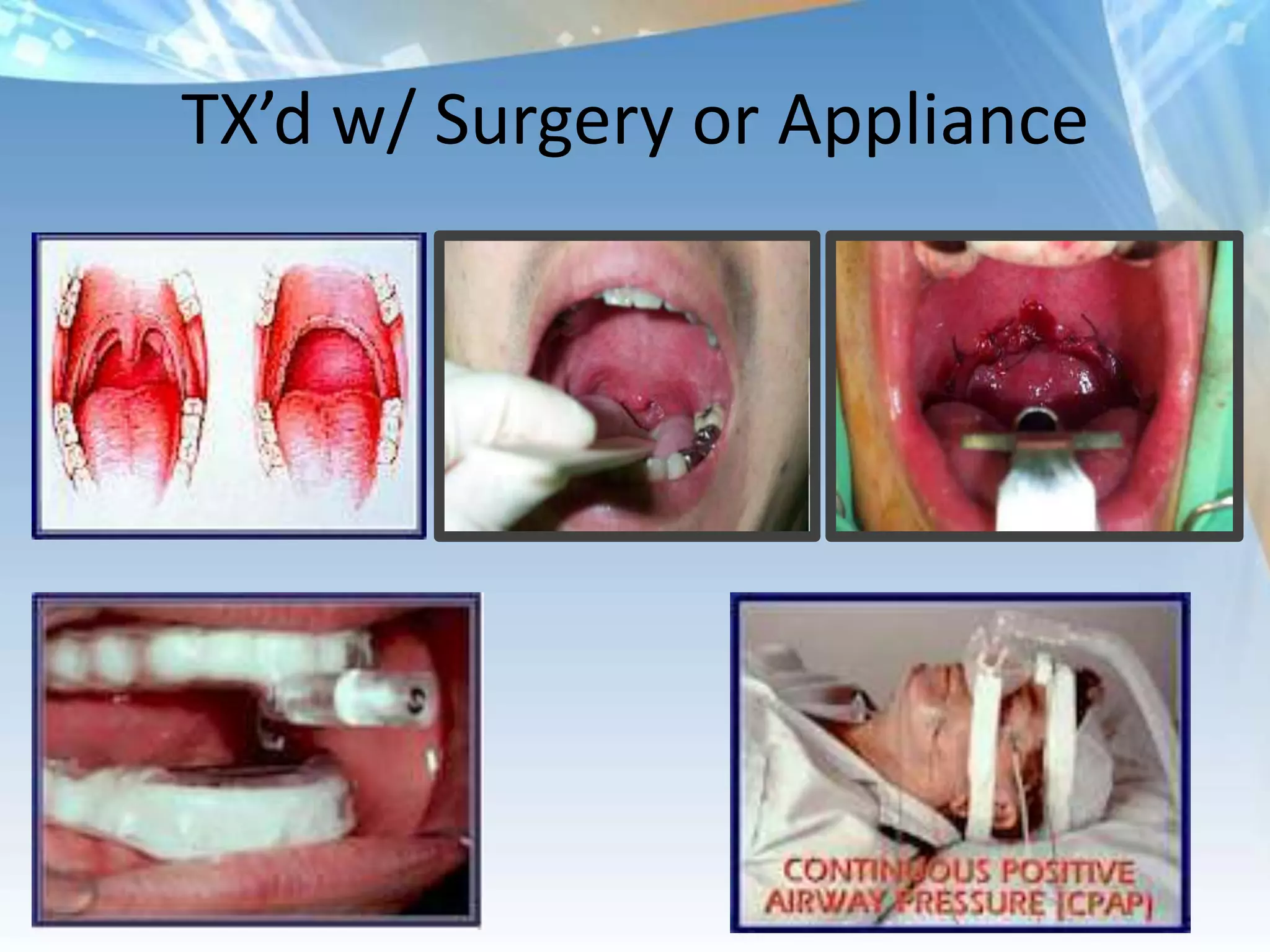 TX’d w/ Surgery or Appliance
 