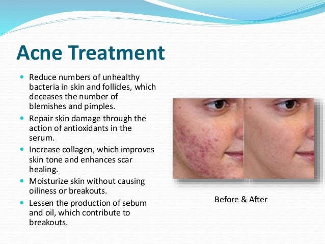 dermalmd scar serum
