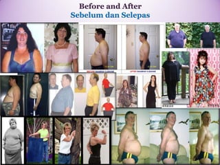 BeforeandAfterSebelumdanSelepas  