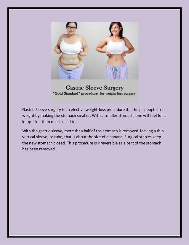 Get Gastric Sleeve in Tijuana to Combat Your Obesity