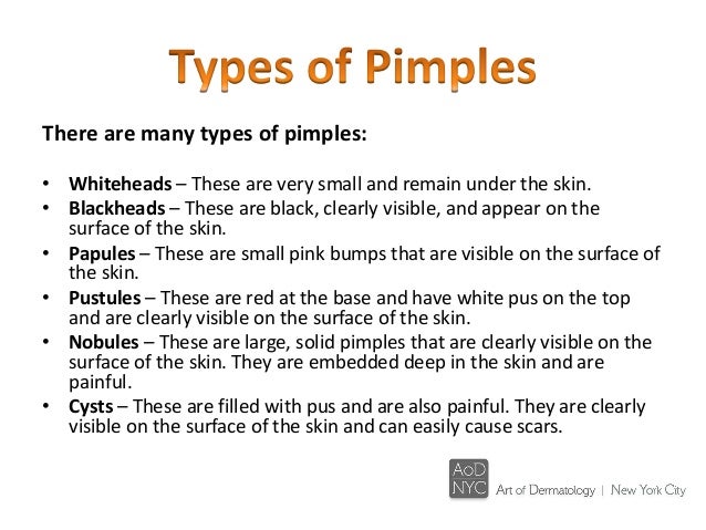 Get Rid of Acne Fast - Treatments for Severe Acne