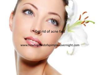 Get rid of acne fast


www.howtogetridofapimplesovernight.com
 