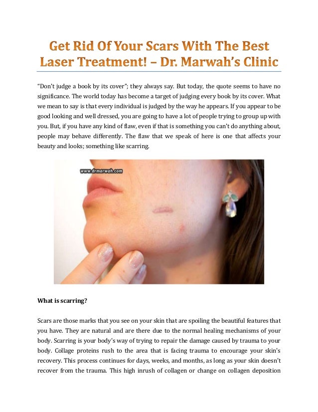 the best treatment for scars
