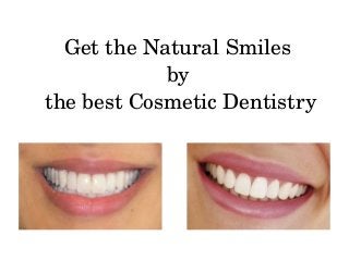 Get the Natural Smiles 
by 
the best Cosmetic Dentistry
 