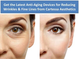 Get the Latest Anti-Aging Devices for Reducing
Wrinkles & Fine Lines from Cartessa Aesthetics
 