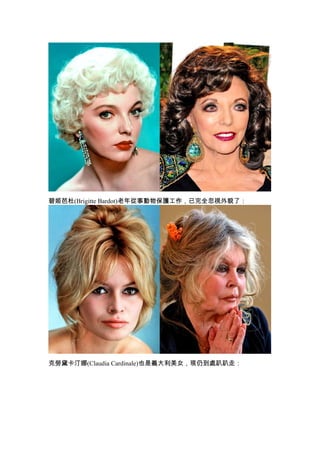 碧姬芭杜(Brigitte Bardot)老年從事動物保護工作，已完全忽視外貌了：




克勞黛卡汀娜(Claudia Cardinale)也是義大利美女，現仍到處趴趴走：
 