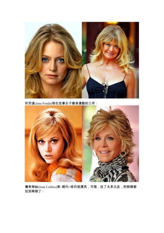 珍芳達(Jane Fonda)現在從事女子瘦身運動的工作：




瓊考琳絲(Joan Collins)演<朝代>時仍很漂亮，可惜，拉了太多次皮，把眼睛都
拉到兩側了：
 