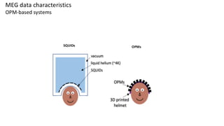 MEG data characteristics
OPM-based systems
SQUIDs OPMs
 