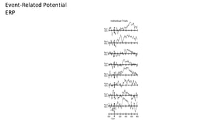 Individual Trials Averaged Trials
Event-Related Potential
ERP
 