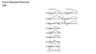 Individual Trials Averaged Trials
Event-Related Potential
ERP
 