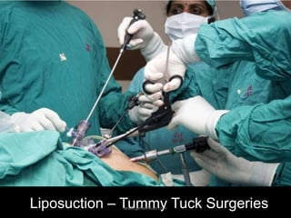 Liposuction – Tummy Tuck Surgerieswww.getwelluae.com
 