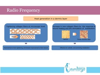 Improvement of skin tightening, and tension improvement of skin texture
Heat generation in a dermis layer
Tightening collagen fibers at microscopic level
Heat
Increase in new collagen fibers by the response of
wound healing and the stimulation of metabolism.
Before Three months later
Radio Frequency
Effective for cellulite, and promoting metabolism
 
