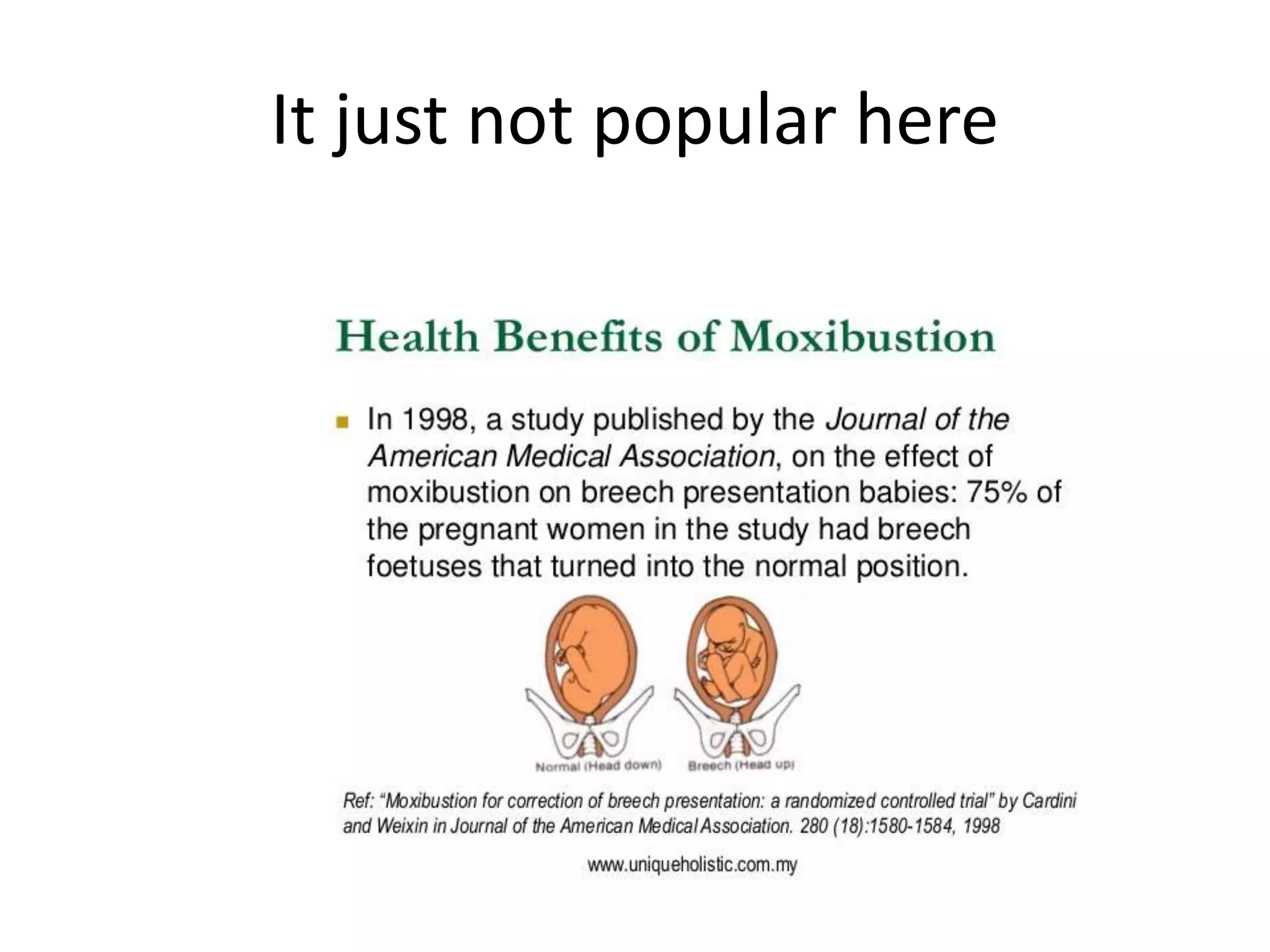 It just not popular here
 