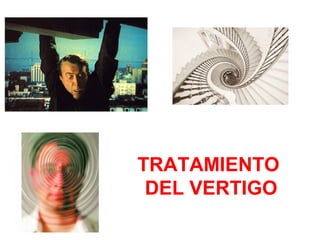 TRATAMIENTO 
DEL VERTIGO 
 