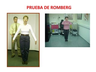 PRUEBA DE ROMBERG 
 