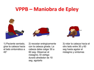 VPPB – Maniobra de Epley 
1) Paciente sentado, 
girar la cabeza hacia 
el lado sintomático a 
45° 
2) recostar enérgicamente 
con la cabeza girada. La 
cabeza debe colgar 30 a 
60 seg. Observar el 
nistagmo. El vértigo 
durará alrededor de 10 
seg. agotarlo 
3) rotar la cabeza hacia el 
otro lado entre 30 y 60 
seg hasta agotar el 
nistagmo y síntomas 
 