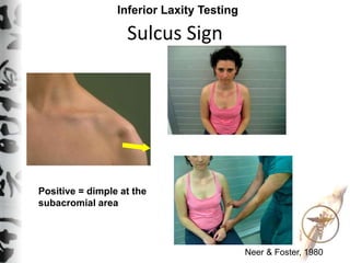 Positive Sulcus Chengdu instability clinical examination | PPTX