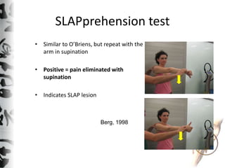 SLAPprehension test
• Similar to O’Briens, but repeat with the
arm in supination
• Positive = pain eliminated with
supinat...