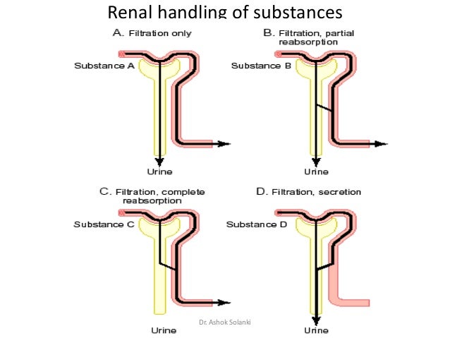 1 reason and 13 factors of kidney stones 48 1 reason and 13 factors of kidney stones 49