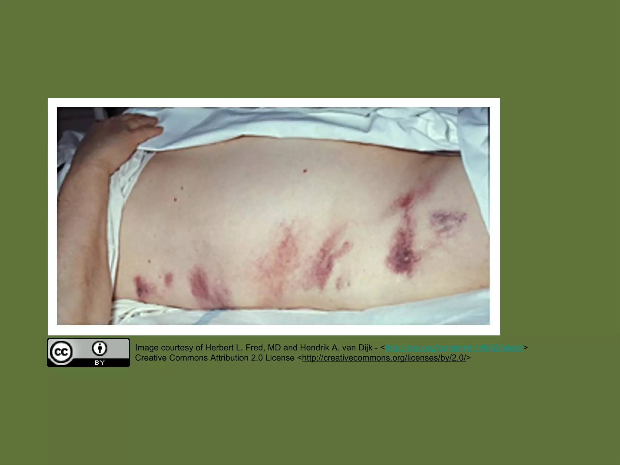 Mostly: When possible, use only Openly Licensed  (or  Public Domain ) Content 