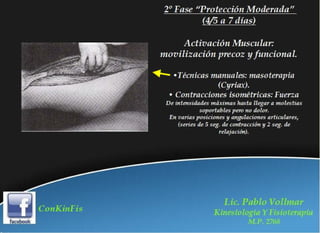 Rehabilitación en Desgarros del Recto Anterior del Muslo
